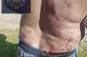 В Курской области ранен водитель грузового автомобиля